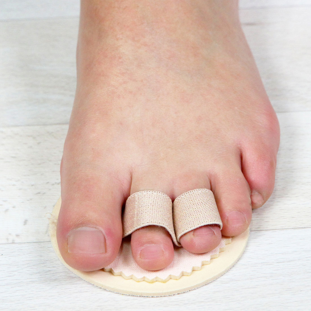 Причины судорог пальцев ног и их лечение